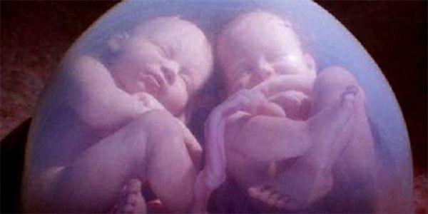 31670264_10216377601411977_4549458595212689408_n